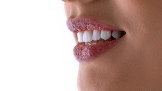 a close up of a woman's mouth with white teeth